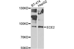 Western blot analysis of extracts of BT474 and HepG2 cells, using ECE2 antibody. (ECE2 anticorps)