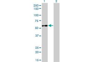 Western Blot analysis of IMPDH2 expression in transfected 293T cell line by IMPDH2 monoclonal antibody (M01), clone 1E12-B6. (IMPDH2 anticorps  (AA 1-514))