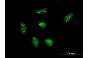 Immunofluorescence of monoclonal antibody to RPL21 on HeLa cell. (RPL21 anticorps  (AA 2-85))