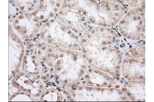 Immunohistochemical staining of paraffin-embedded Human liver tissue using anti-PDE4A mouse monoclonal antibody. (PDE4A anticorps)