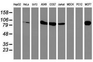 Image no. 10 for anti-phosphofructokinase, Platelet (PFKP) antibody (ABIN1500164)