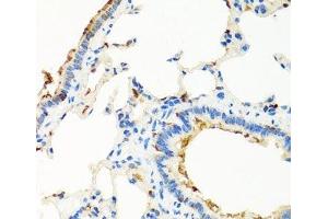 Immunohistochemistry of paraffin-embedded Rat lung using RGS5 Polyclonal Antibody at dilution of 1:100 (40x lens).