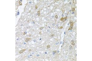 Immunohistochemistry of paraffin-embedded rat brain using RAPSN antibody (ABIN6132583, ABIN6146690, ABIN6146691 and ABIN6222434) at dilution of 1:100 (40x lens).