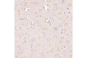 Immunohistochemistry of paraffin-embedded mouse brain using ABCF2 antibody (ABIN6291735) at dilution of 1:100 (40x lens). (ABCF2 anticorps)
