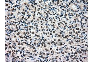 Image no. 15 for anti-Premelanosome Protein (PMEL) antibody (ABIN1500300)