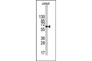 Image no. 1 for anti-6-phosphofructo-2-Kinase/fructose-2,6-Biphosphatase 1 (PFKFB1) (Middle Region) antibody (ABIN360657) (PFKFB1 anticorps  (Middle Region))