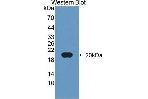Detection of Recombinant MHCDG, Human using Polyclonal Antibody to Cluster Of Differentiation 74 (CD74) (CD74 anticorps  (AA 78-222))