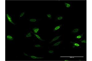 Immunofluorescence of monoclonal antibody to CDC2L6 on HeLa cell.