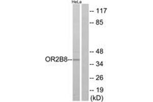 Western blot analysis of extracts from HeLa cells, using OR2B8 Antibody. (OR2B8P anticorps  (AA 61-110))