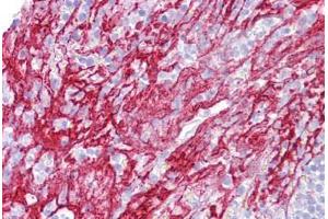 Anti-APOH / Apolipoprotein H antibody IHC staining of human tonsil.