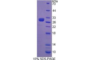 Image no. 1 for Interferon alpha/beta Receptor 2 (IFNAR2) (AA 27-243) protein (His tag) (ABIN6237032) (IFNAR2 Protein (AA 27-243) (His tag))