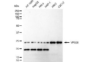 Western blotting analysis using VPS28 antibody (ABIN7800926). (Recombinant VPS28 anticorps)