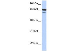 MAP3K7IP1 antibody used at 1 ug/ml to detect target protein. (TAB1 anticorps  (N-Term))