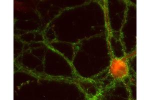 Indirect immunostaining of PFA fixed rat hippocampus neurons with anti-EPS 8 (dilution 1 : 500; red) and mouse anti-synaptotagmin 1 (cat. (EPS8 anticorps)