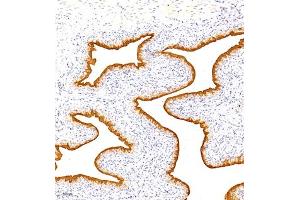 Immunohistochemistry analysis of paraffin embedded rat bladder using TGDS (ABIN7075850) at dilution of 1: 1500 (TGDS anticorps)