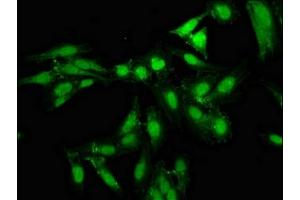 Immunofluorescence staining of Hela cells with ABIN7161386 at 1:133, counter-stained with DAPI. (NPAS2 anticorps  (AA 644-763))