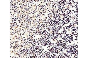 IHC analysis of FFPE human thymus section using FOXP1 antibody; Ab was diluted at 1:25.