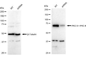 Western blotting analysis using PKC delta + PKC theta antibody (ABIN7799841). (Recombinant PKC delta + PKC theta anticorps)