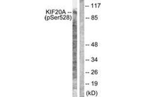Western blot analysis of extracts from 293 cells, using KIF20A (Phospho-Ser528) Antibody.