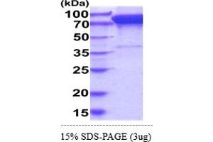 SDS-PAGE (SDS) image for Discoidin Domain Receptor tyrosine Kinase 1 (DDR1) (AA 21-417) protein (hIgG-His-tag) (ABIN6388104)