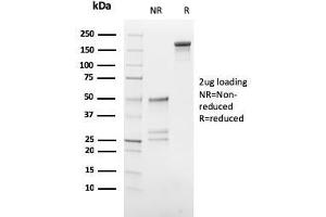 SDS-PAGE Analysis Purified hCG beta Mouse Monoclonal Antibody (HCGb/54). (CGB anticorps)
