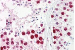 Anti-UBA2 antibody IHC staining of human testis. (UBA2 anticorps  (AA 591-640))