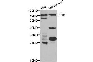 Western blot analysis of extracts of various cell lines, using F10 antibody. (Coagulation Factor X anticorps  (AA 235-488))