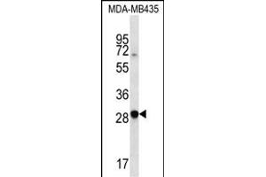 CXCR6 Antibody (N-term) (ABIN657221 and ABIN2846326) western blot analysis in MDA-M cell line lysates (35 μg/lane). (CXCR6 anticorps  (N-Term))