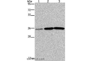 Western blot analysis of Human testis tissue, A549 and PC3 cell, using MAGEA3 Polyclonal Antibody at dilution of 1:400 (MAGEA3 anticorps)