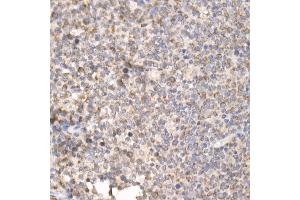 Immunohistochemistry of paraffin-embedded human tonsil using PG Rabbit pAb (ABIN7269317) at dilution of 1:25 (40x lens). (PGAM5 anticorps  (AA 30-225))