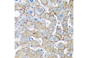 Immunohistochemistry of paraffin-embedded Human liver using UNC13B Rabbit pAb (ABIN7271215) at dilution of 1:100 (40x lens). (UNC13B anticorps  (AA 1-350))