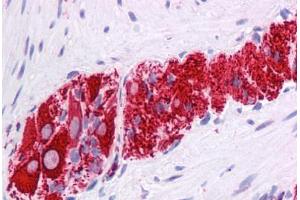 Human Colon, Myenteric Plexus: Formalin-Fixed, Paraffin-Embedded (FFPE)
