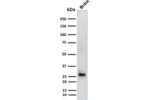 Western Blot Analysis of human Brain tissue lysate using Calretinin Mouse Monoclonal Antibody (CALB2/2602). (Calretinin anticorps  (AA 23-242))