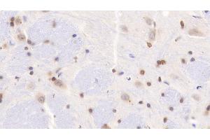 Detection of ADAMTS7 in Rat Cerebrum Tissue using Polyclonal Antibody to A Disintegrin And Metalloproteinase With Thrombospondin 7 (ADAMTS7) (ADAMTS7 anticorps  (AA 444-575))