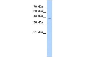 WB Suggested Anti-ASS Antibody Titration:  2.