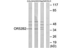 Western blot analysis of extracts from COLO/HuvEc/HepG2 cells, using OR52B2 Antibody. (OR52B2 anticorps  (AA 201-250))