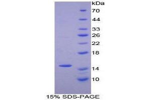 SDS-PAGE (SDS) image for Numb Homolog (NUMB) (AA 376-482) protein (His tag) (ABIN1879487)