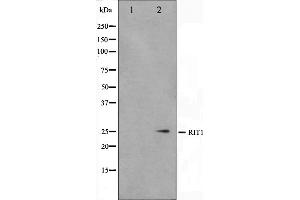 Western blot analysis on Jurkat cell lysate using RIT1 Antibody,The lane on the left is treated with the antigen-specific peptide. (RIT1 anticorps  (C-Term))