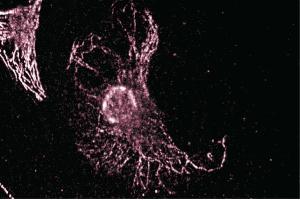 Immunofluorescent staining of NRK cells. (TRIP10 anticorps  (AA 411-501))