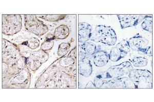 Immunohistochemistry analysis of paraffin-embedded human placenta tissue using PHCA antibody. (ACER3 anticorps  (Internal Region))