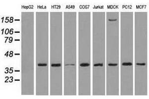 Image no. 3 for anti-Mitogen-Activated Protein Kinase 1 (MAPK1) antibody (ABIN1499287)