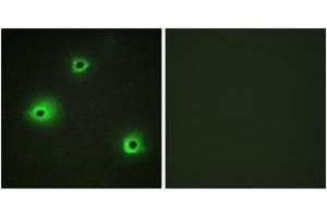 Immunofluorescence analysis of A549 cells, using GRAH Antibody. (GZMH anticorps  (AA 51-100))
