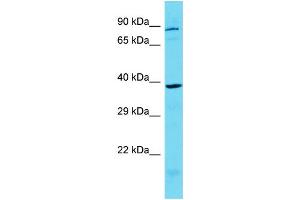 Host: Rabbit Target Name: KCTD1 Sample Type: MCF7 Whole Cell lysates Antibody Dilution: 1.