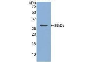 Detection of Recombinant CLU, Human using Polyclonal Antibody to Clusterin (CLU) (Clusterin anticorps  (AA 228-449))