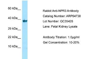 Western Blotting (WB) image for anti-Atrial Natriuretic Peptide Receptor 3 (NPR3) (C-Term) antibody (ABIN2789944) (NPR3 anticorps  (C-Term))