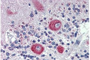 Human Brain, cerebellum: Formalin-Fixed, Paraffin-Embedded (FFPE)