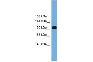 WB Suggested Anti-Parp8 Antibody Titration: 0. (PARP8 anticorps  (N-Term))