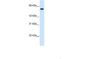 WB Suggested Anti-FTCD Antibody  Titration: 1. (FTCD anticorps  (N-Term))