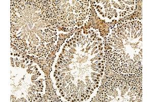 ABIN7096114 and ABIN7100176 at 1/100 staining rat testis tissue by IHC-P. (PYM anticorps)