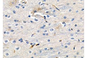 ABIN6257242 and ABIN6273630 at 1/100 staining Rat brain tissue by IHC-P. (GRIP1 anticorps  (Internal Region))